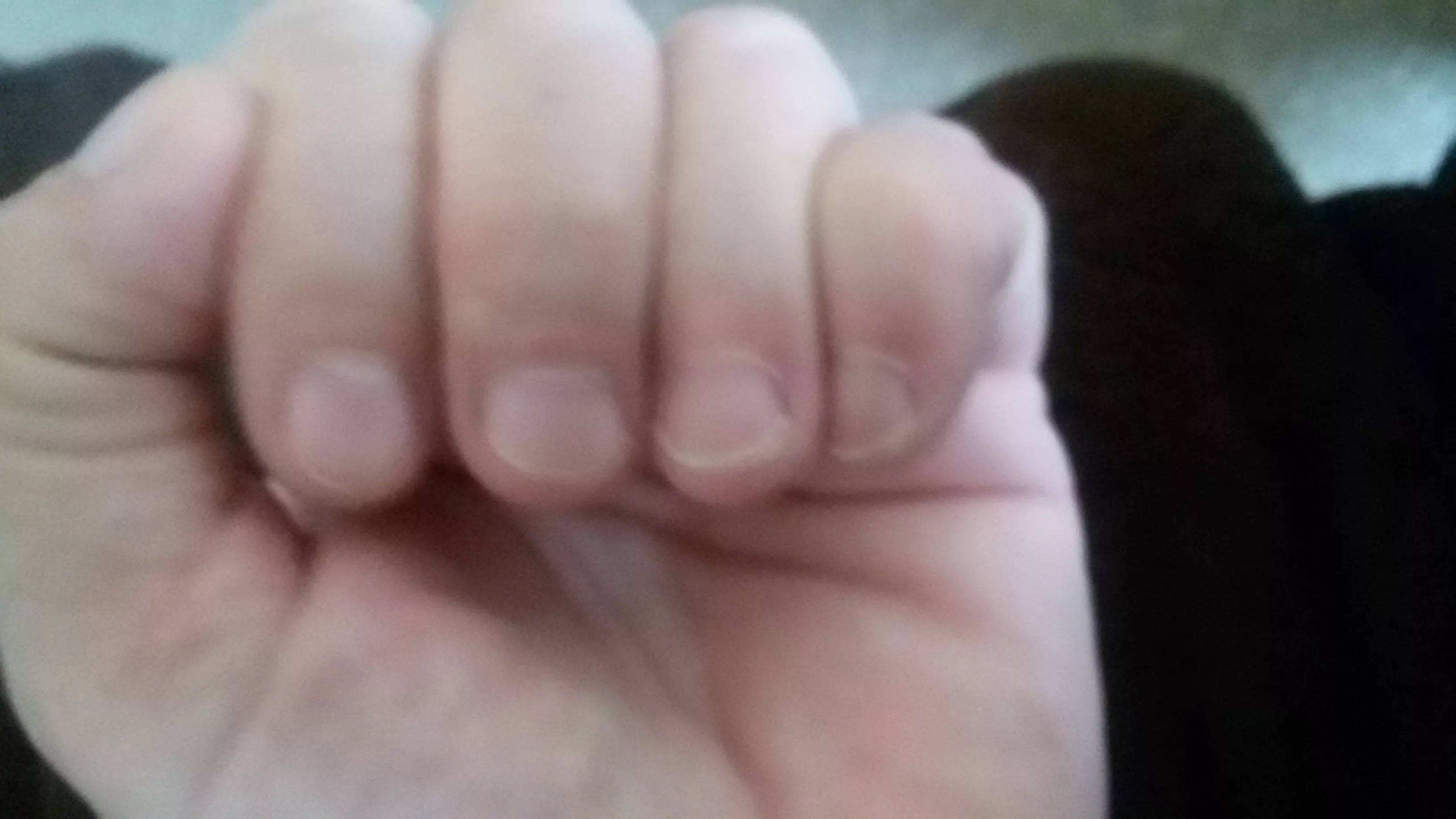 Kinams net senatvėje neskauda sąnarių, o viskas dėl to, kad jie 1 kartą per dieną