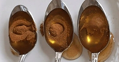 Kaip vartoti cinamoną su medumi?