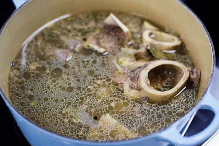 Уретровагинальды фистула цистоскопиясы