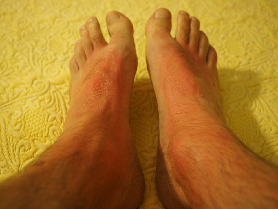 Ar savo namuose laikote tokį kremą? Esu visiškai tikra, nežinote jo panaudojimo galimybių! visų galimų panaudojimo galimybių!
